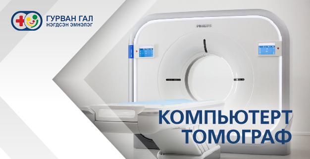 Компьютерт томографи