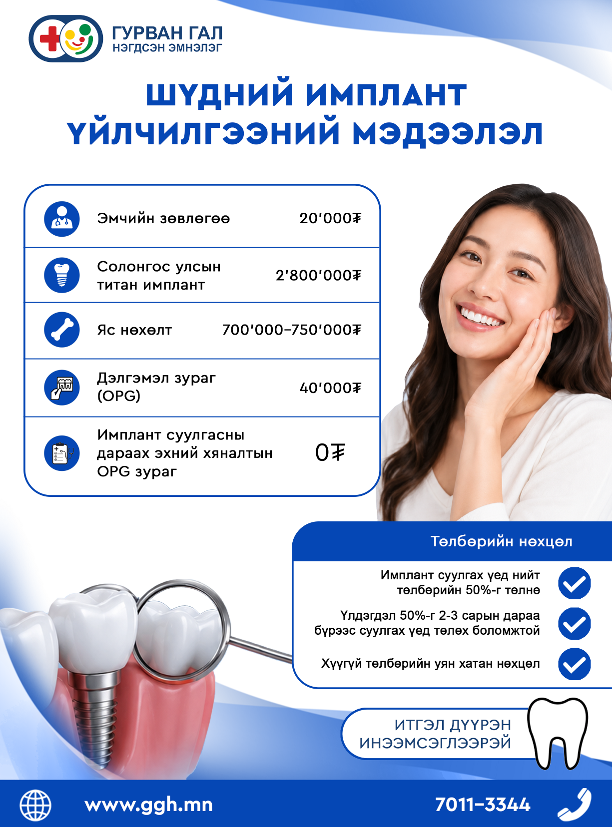 Шүдний имплант үйлчилгээний мэдээлэл